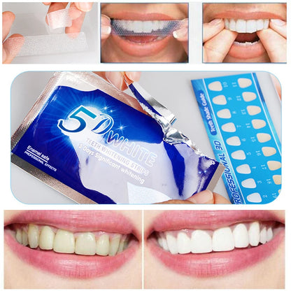 TIRAS BLANQUEADORAS DENTALES
