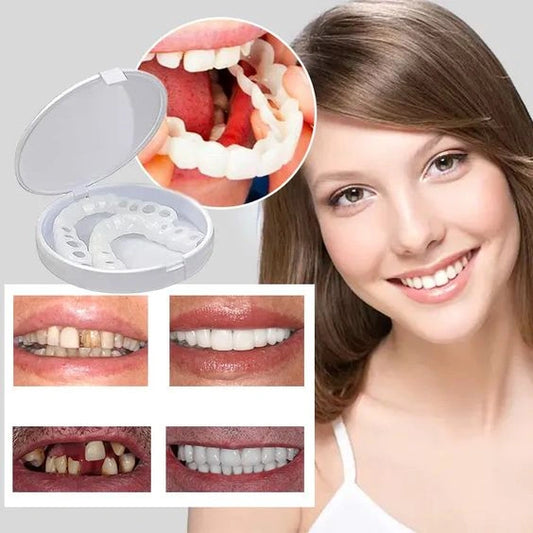 CARILLAS SNAP-ON SMILE: ¡TRANSFORMA TU SONRISA EN SEGUNDOS!